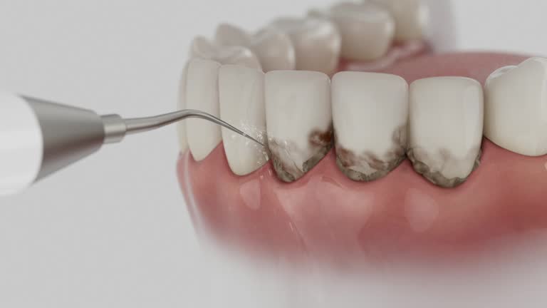 Reliable Dental Implants contractor in Clinton, AR by Smile Center Dentistry